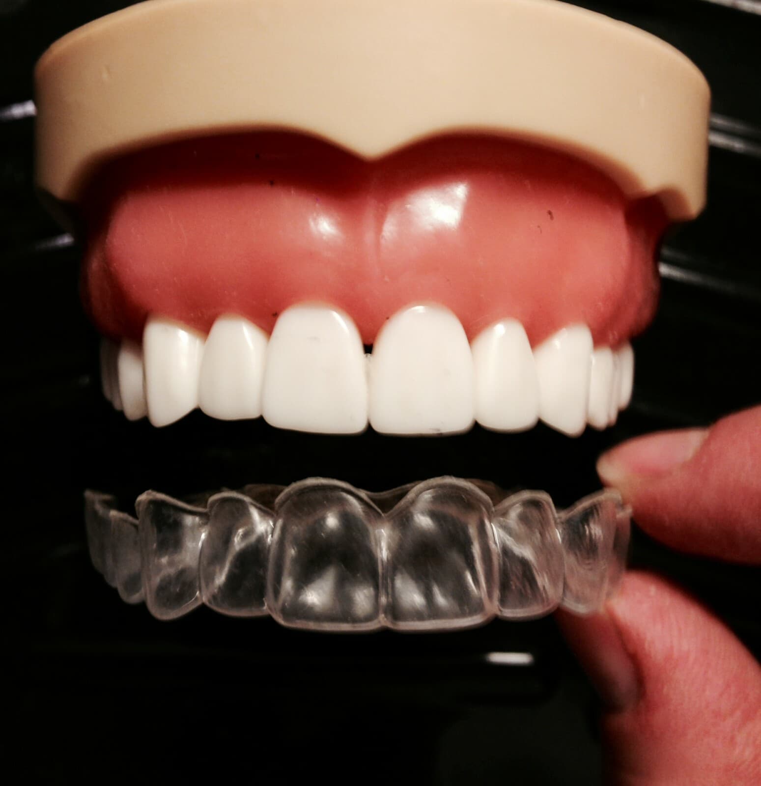 Custom Dental Retainers Upper AND Lower Set- Aligner Type Made by USA Dental Lab 3