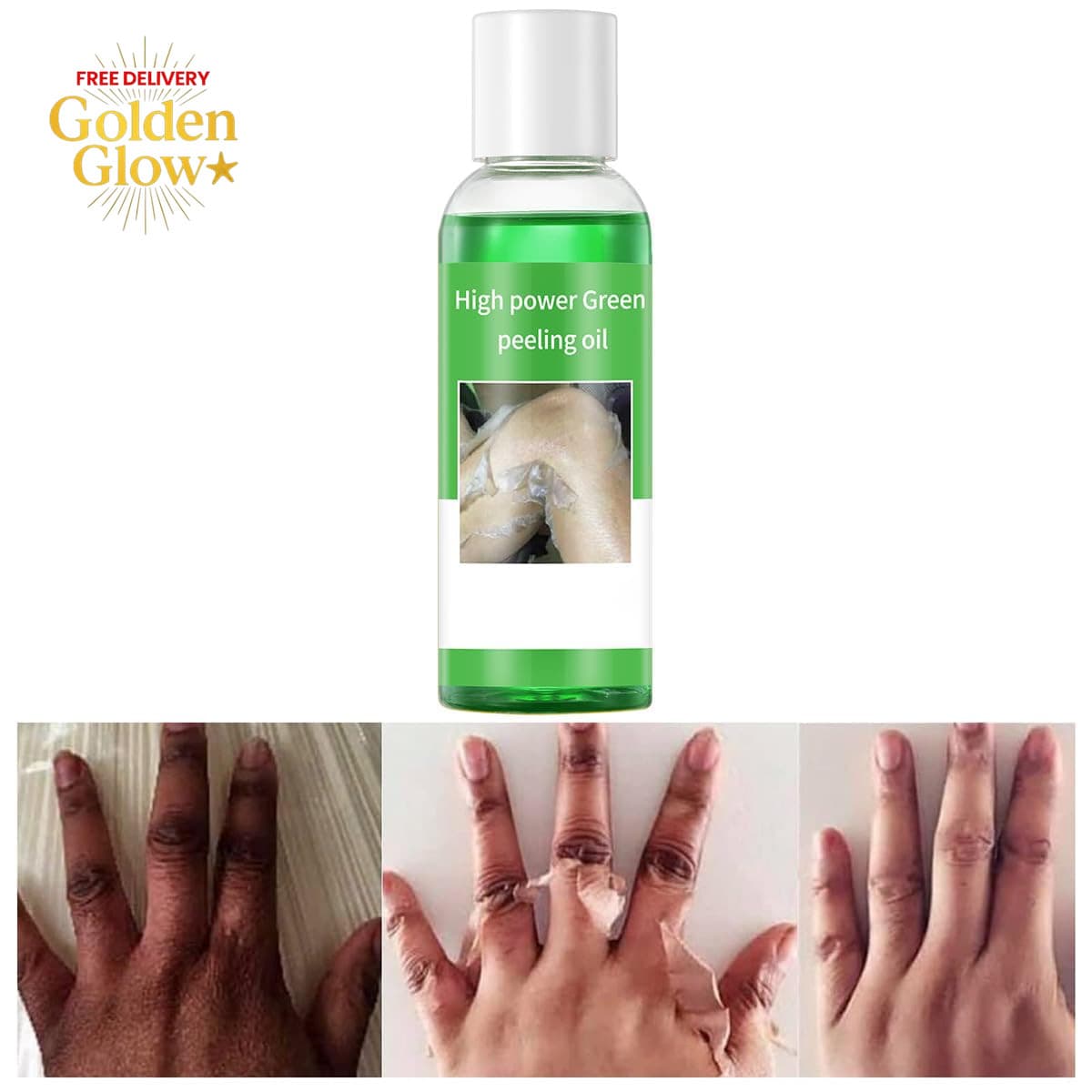 Peeling Oil for Dark Skin, Green Peeling Oil, Facial Peels with Hyaluronate,Exfo
