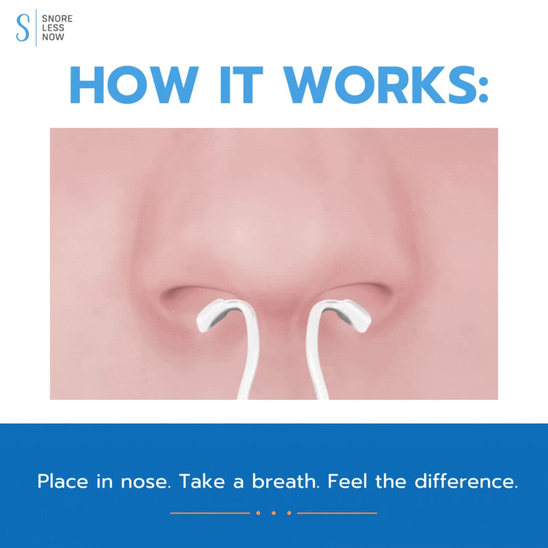 SnoreLessNow Nasal Dilator SMALL | Reduce Snoring | Swiss Made | FDA Registered 3