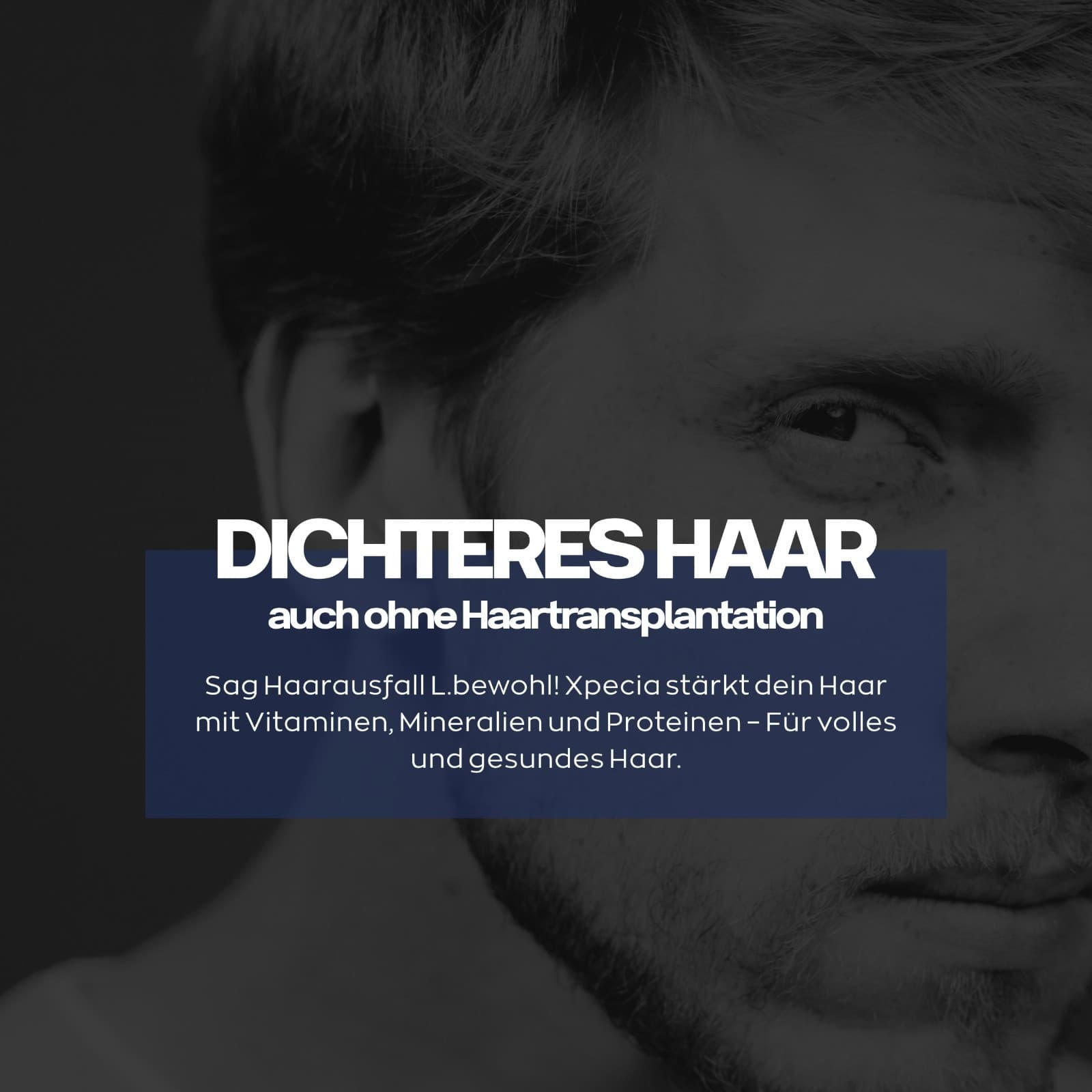 3x60 Tablets=180 Tablets Xpecia DHT Blocker with Biotin and Saw Palmetto Extract  5