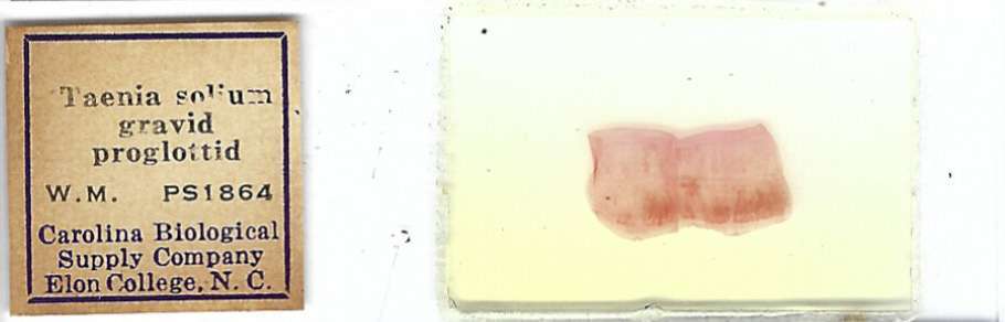Taenia solium Gravid Proglottid w.m. Microscope Slide