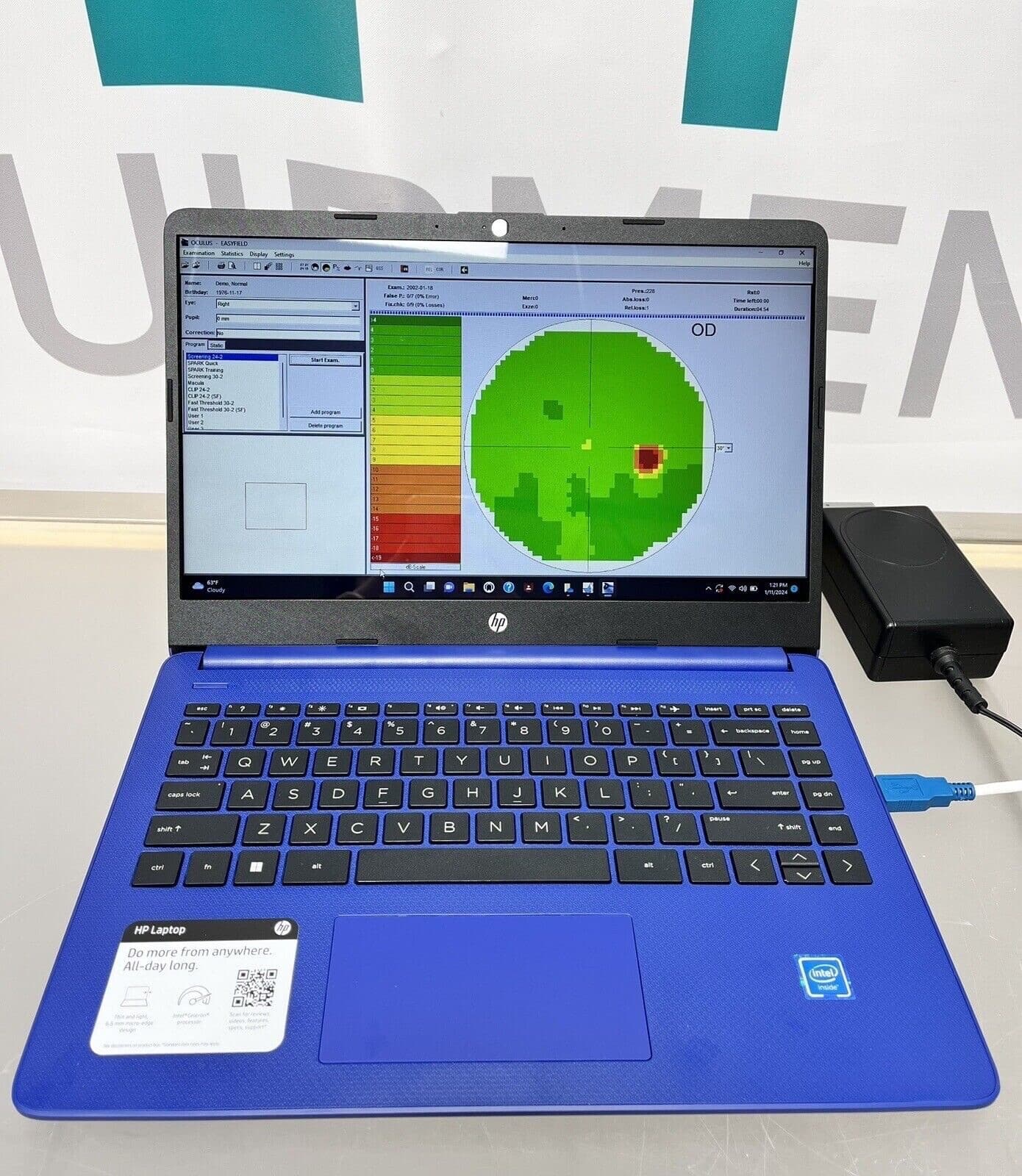 Oculus Easyfield Perimeter Visual Field Tester w/ HP Laptop 4