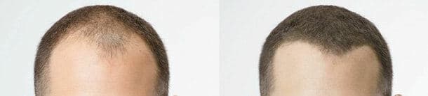 Hair Fibers For Xfusion Bottles -  Refill Bag FAST SHIP FROM USA 4