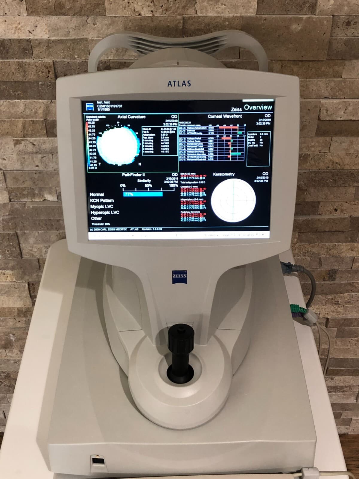 Carl Zeiss Atlas 9000 Topographer with Keyboard and Windows 10 6