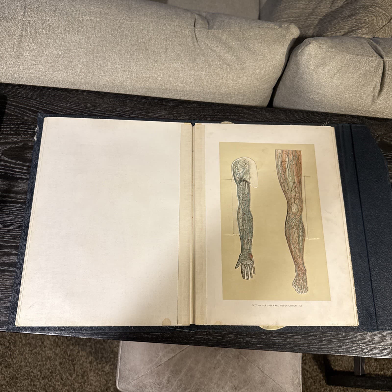 Embalmer's Anatomical Aid, late 19th century 3