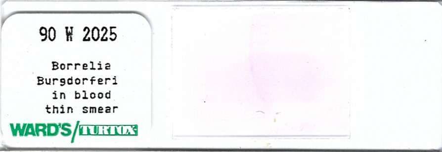 Borrelia  burgdorferi in Blood Thin Smear Microscope Slide