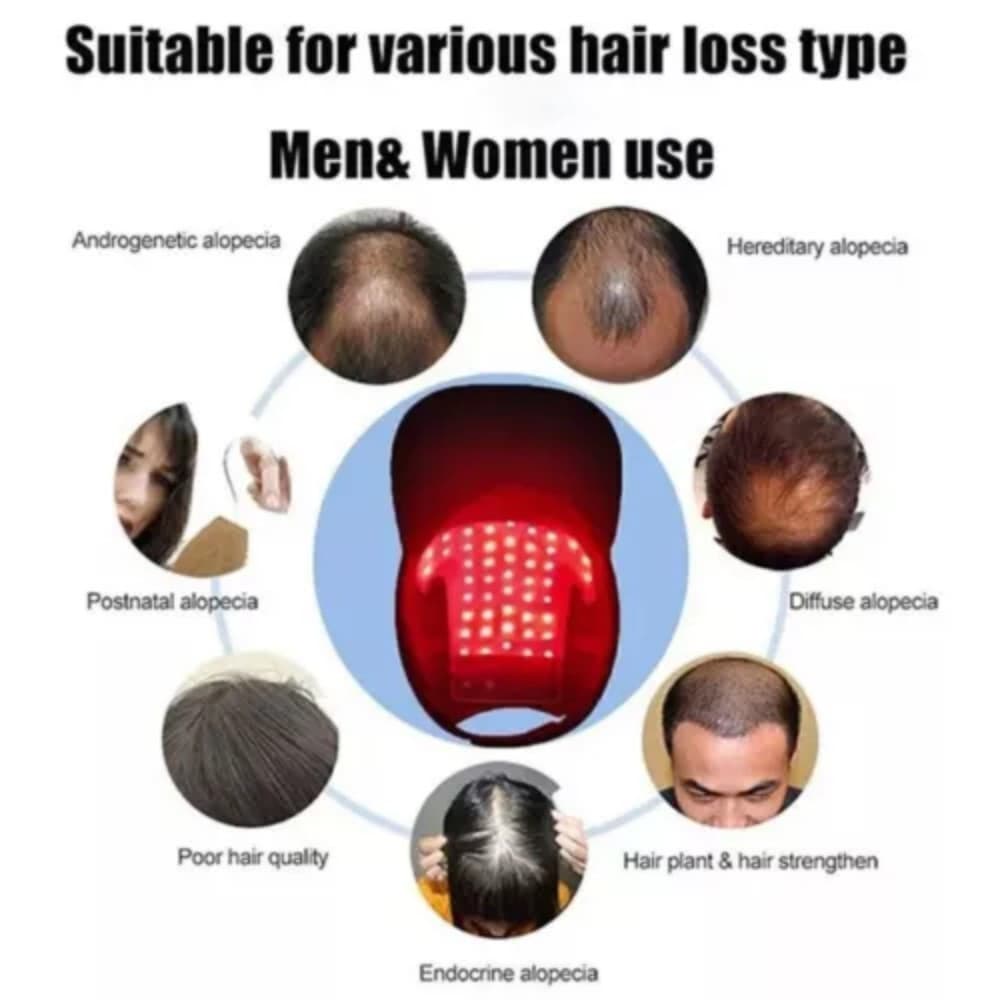 Hair Loss Treatment Heating Cap Red Light Therapy Hat Hair Growth Regrowth US 4