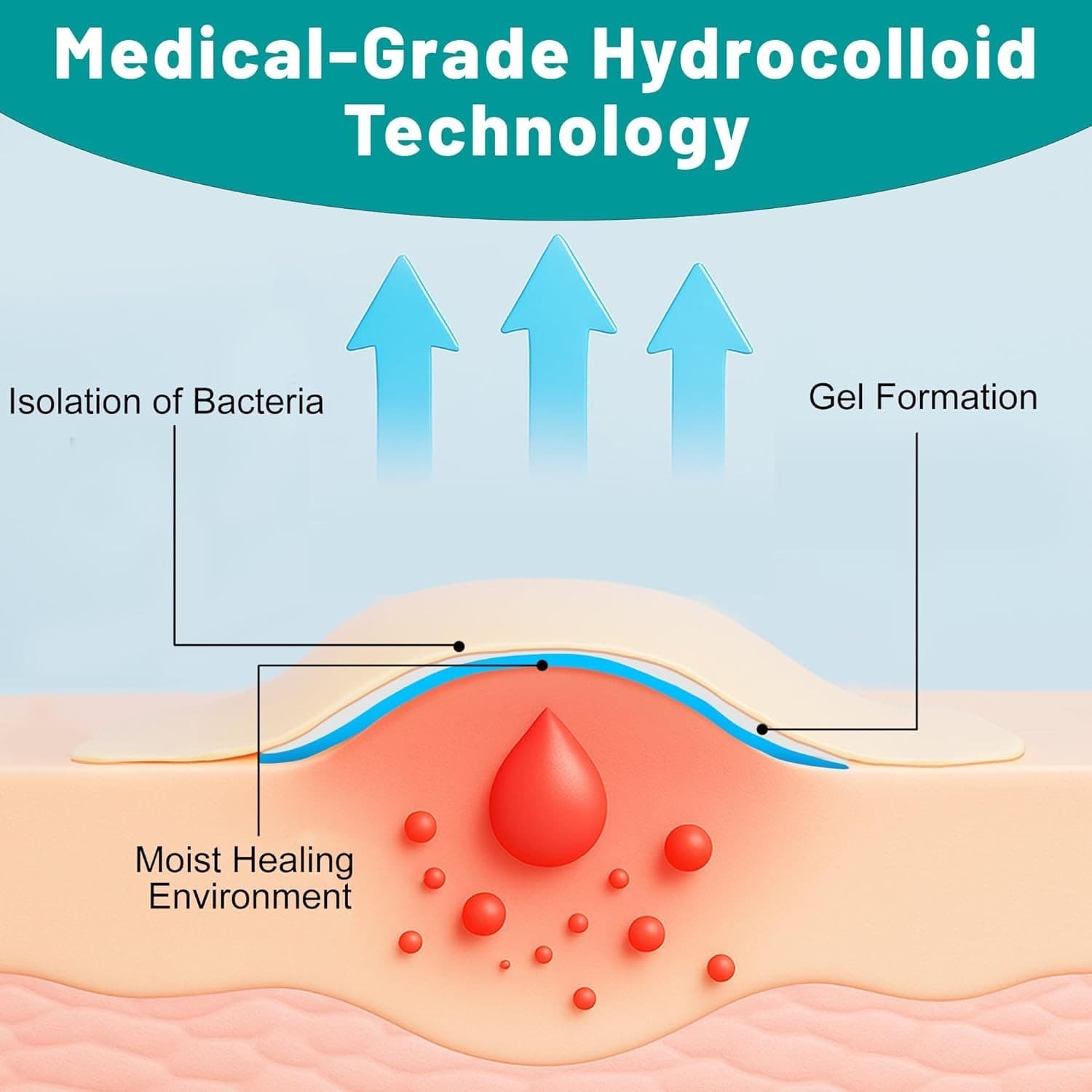 Hydrocolloid Bandages Roll for Wound Care, 2In*6Ft Hydrocolloid Patch, Hypoalle 4