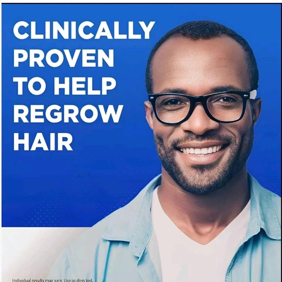 Kirkland Minoxidil 5% Extra Strength Men 6 Month Supply Hair Regrowth Solution 3