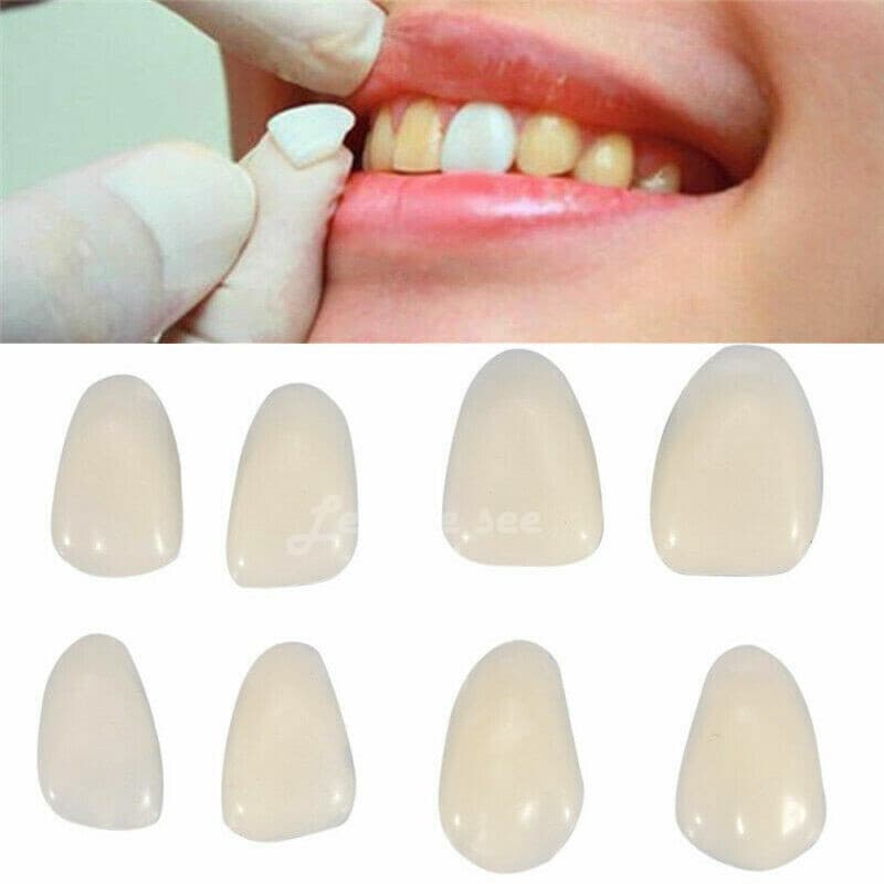 96pc Tooth Veneer 23 Dental Veneers Porcelain Anterior Resin Thin Teeth A1 A2 A3 5
