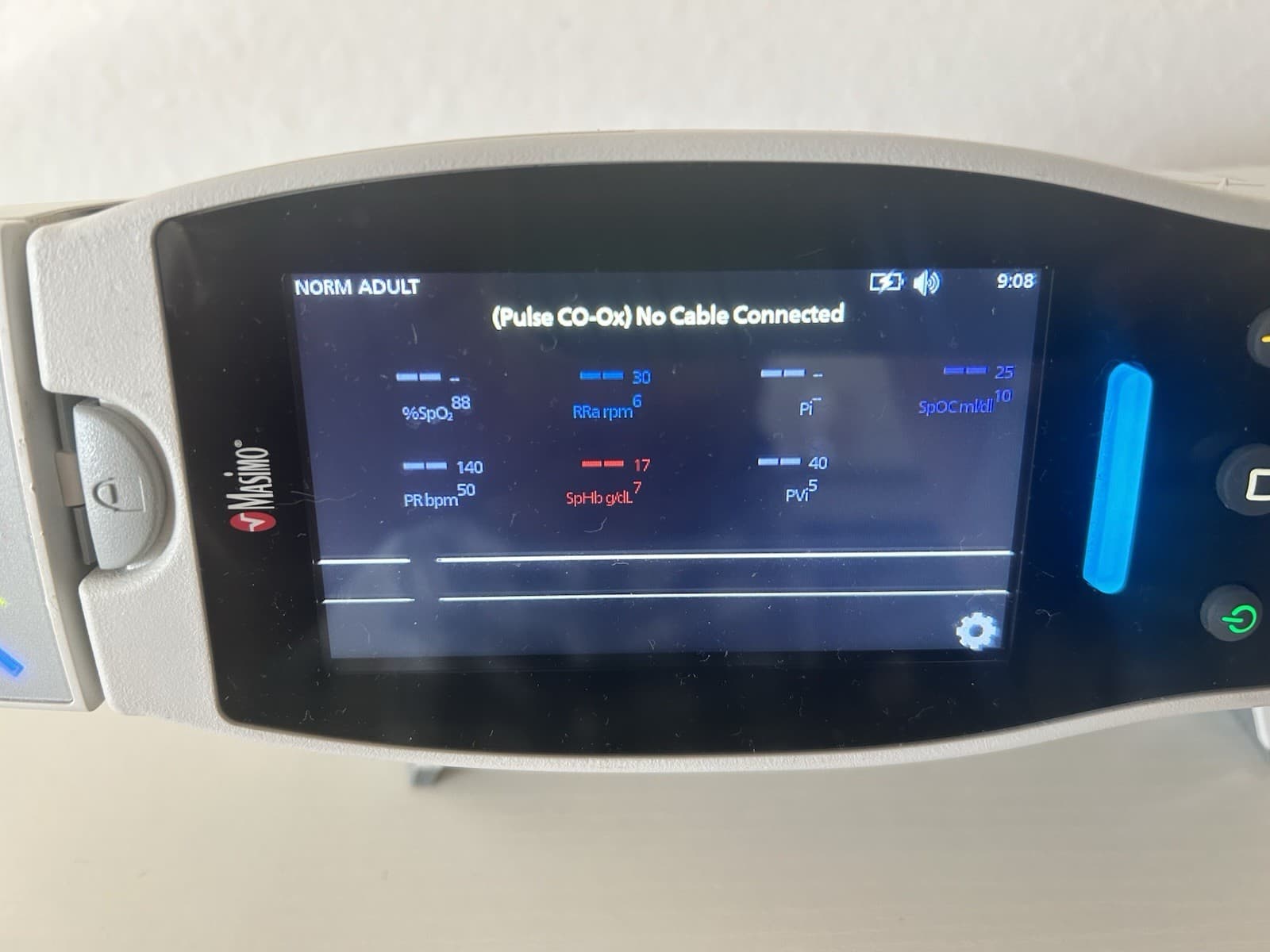 Masimo Rainbow Radical 7 with SpHb, Spo2 ,spoc,PVi, SpMet, RRa,Pi & RC-12 2