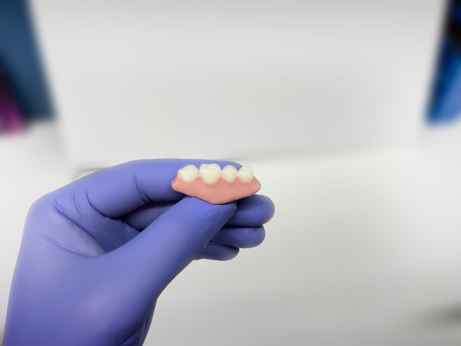 I made my own homemade dentures with Denturi 3