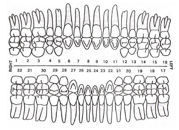#11 Upper Left Cuspid tooth - Dental Polycarbonate Temporary Crowns 7 sizes  2