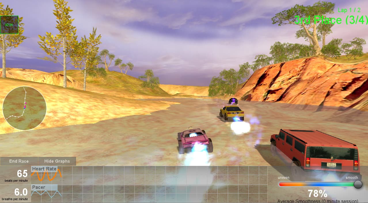 Alive Pro 1 SCL+ HRV Biofeedback Complete Super User System  5