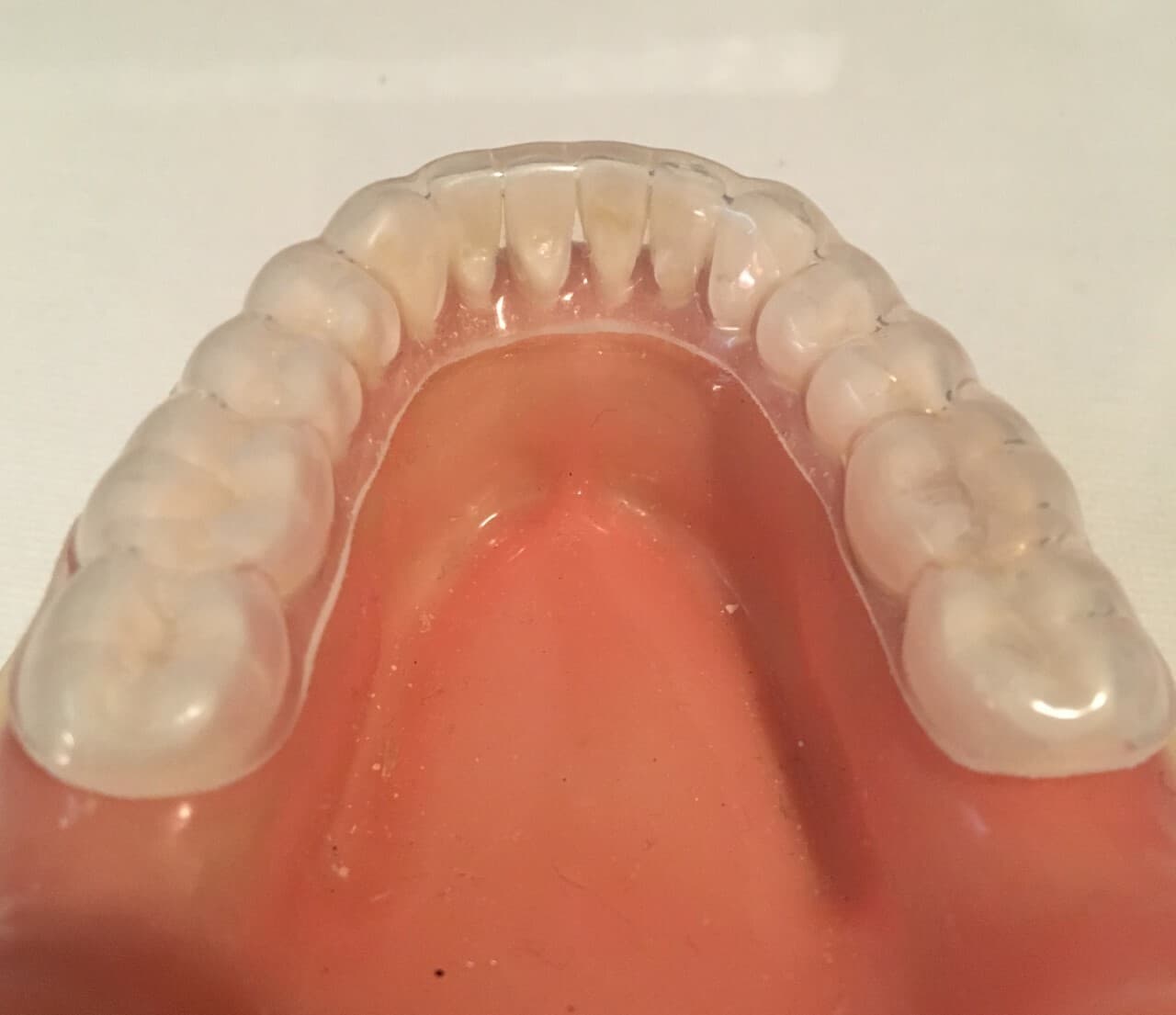 Custom Dental Retainers Upper AND Lower Set- Aligner Type Made by USA Dental Lab 6