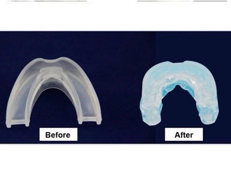 2x Stop Snoring Solution Mouthpiece Sleeping Aid Apnea Guard Anti Snore Stopper 6