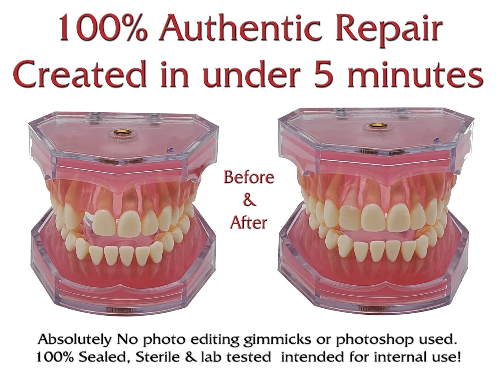 SmileFix Color Matching Deluxe Dental Repair Kit - Replace Missing or Broken ... 2