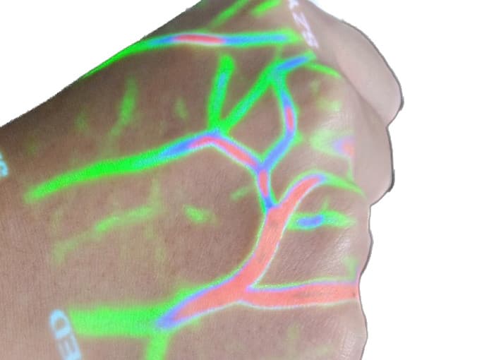 Infrared Vein Finder Vascular Imaging Viewer with Depth Detection FDA Warranty 5