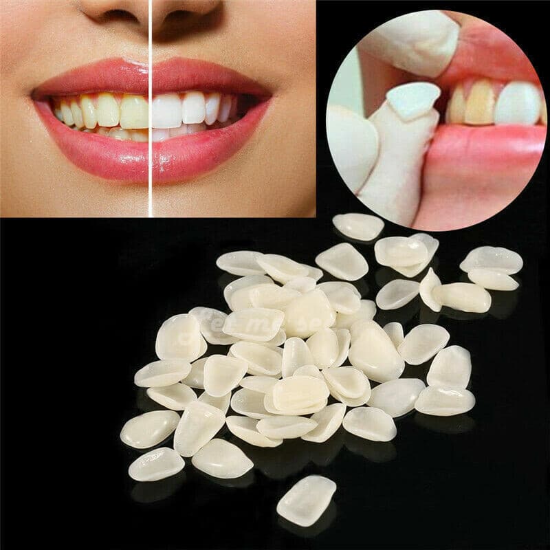 96pc Tooth Veneer 23 Dental Veneers Porcelain Anterior Resin Thin Teeth A1 A2 A3 2