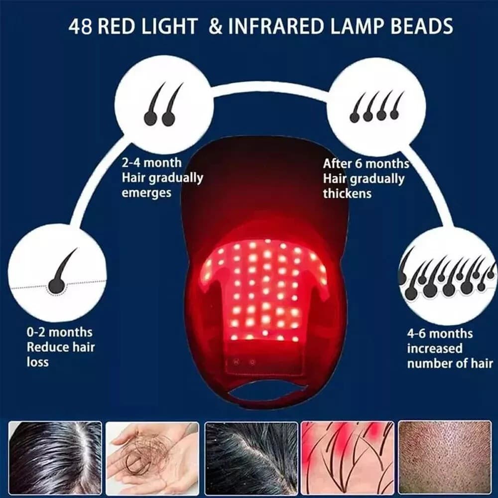 Hair Loss Treatment Heating Cap Red Light Therapy Hat Hair Growth Regrowth US 5