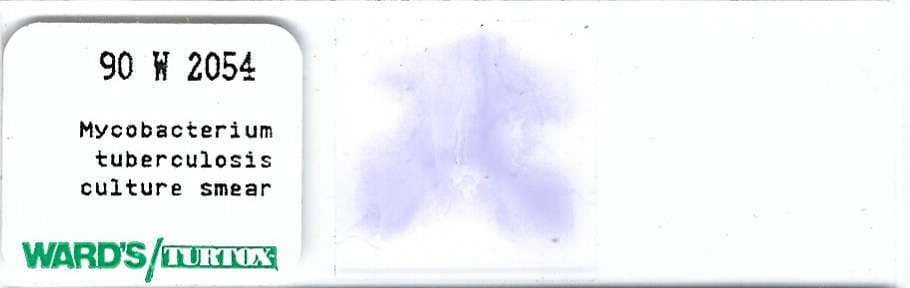 Mycobacterium tuberculosis Culture Smear Microscope Slide