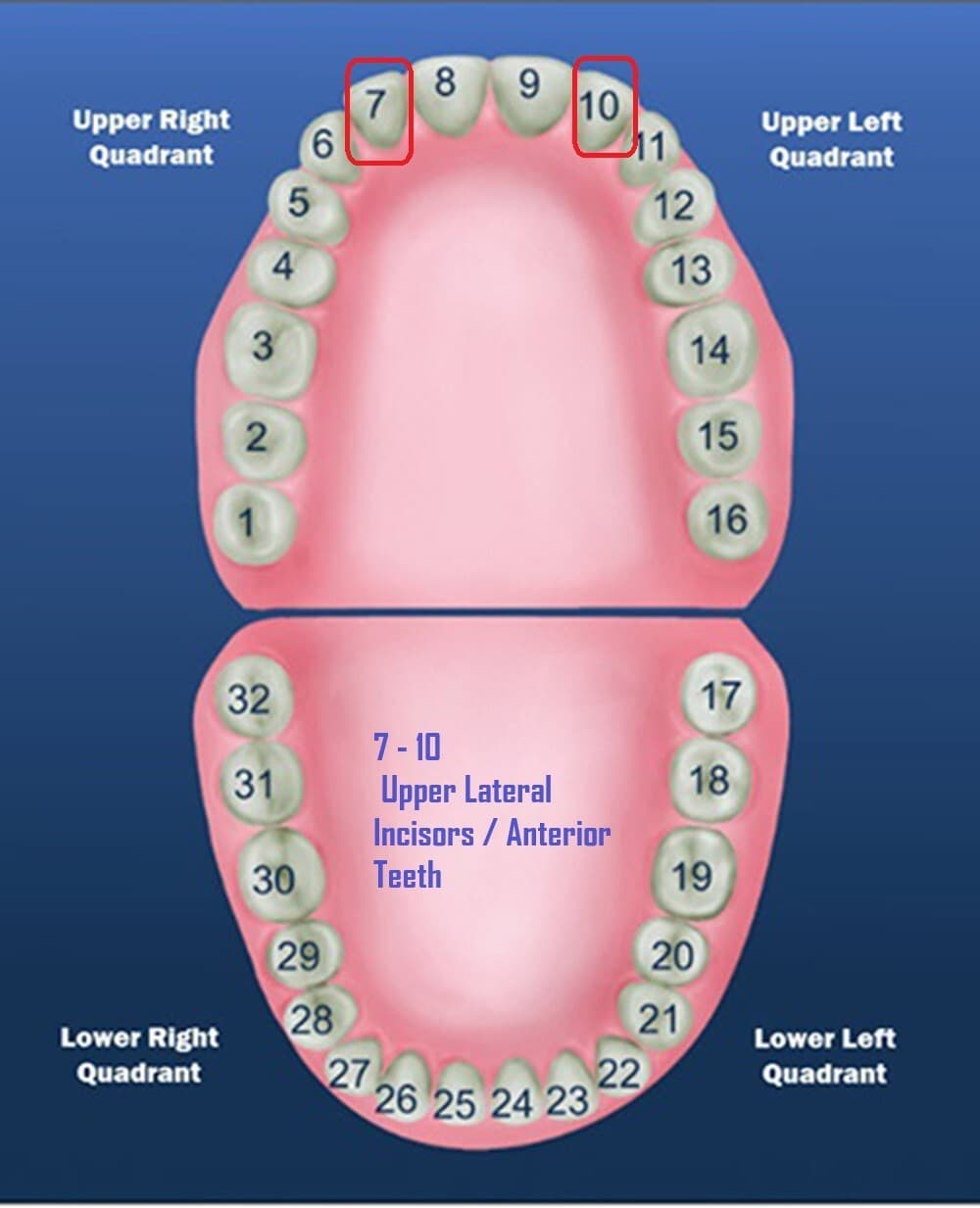 DENTAL POLYCARBONATE TEMPORARY CROWNS #29 (ULL) UPPER LEFT LATERAL 5/PACK 3