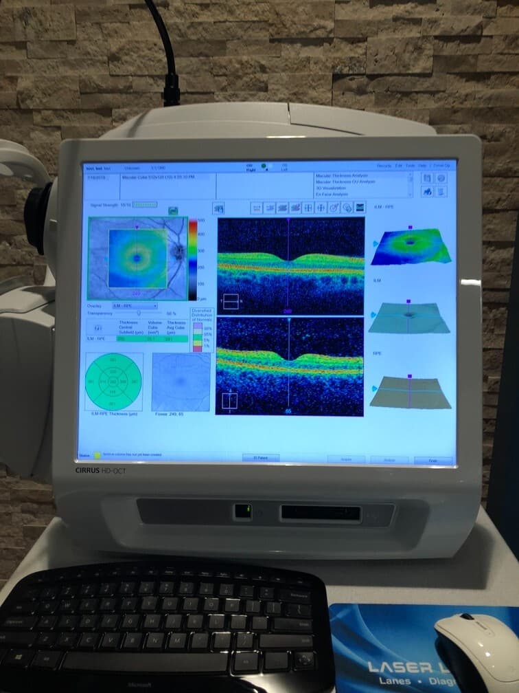 Carl Zeiss Cirrus 5000 HD OCT Ophthalmic Tomographer HD-OCT Windows 10 2