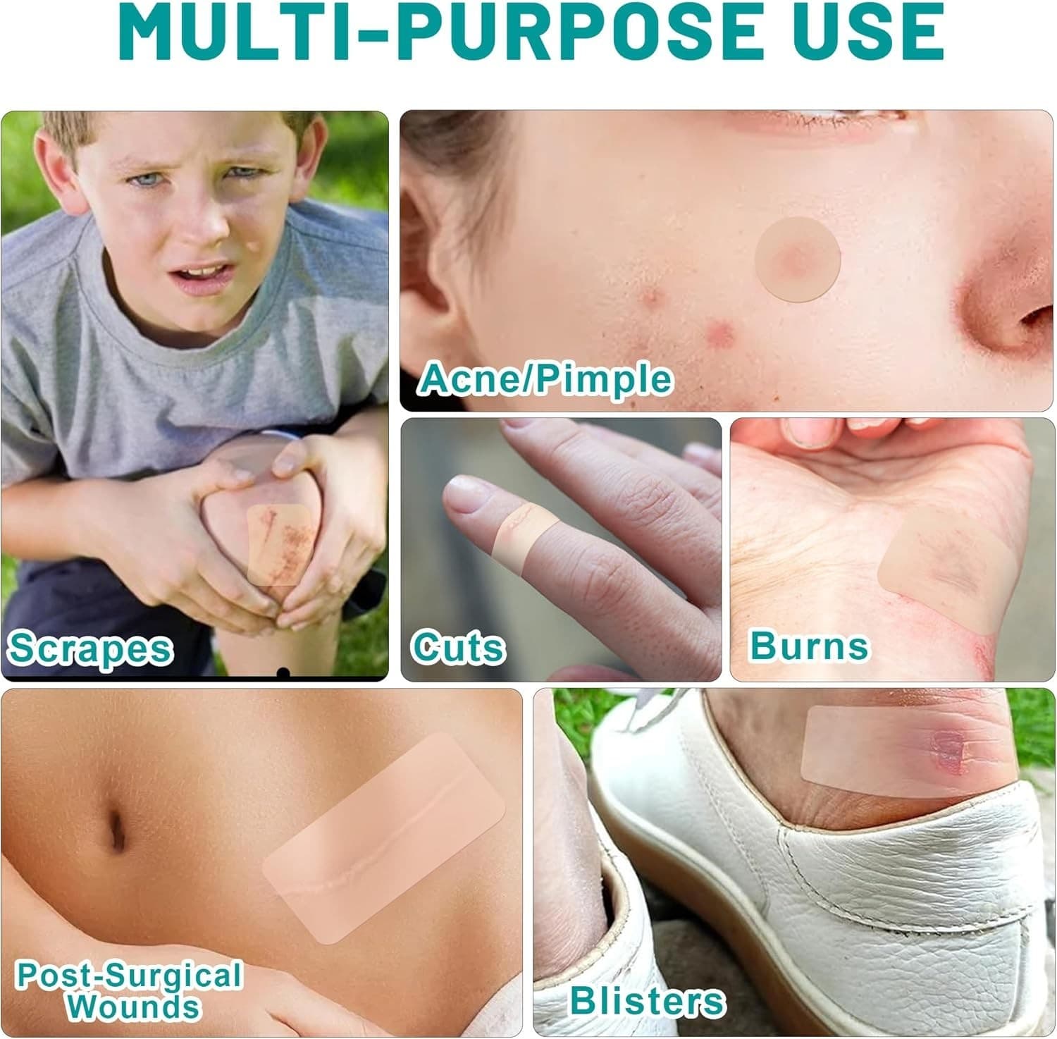 Hydrocolloid Bandages Roll for Wound Care, 2In*6Ft Hydrocolloid Patch, Hypoalle 5