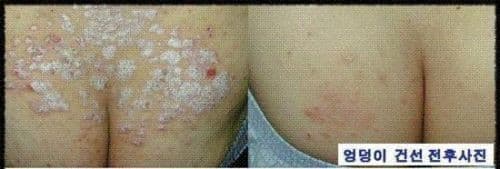 3 Lot of  ISAL Atopy Eczema Cream Lotion./Made in USA 4