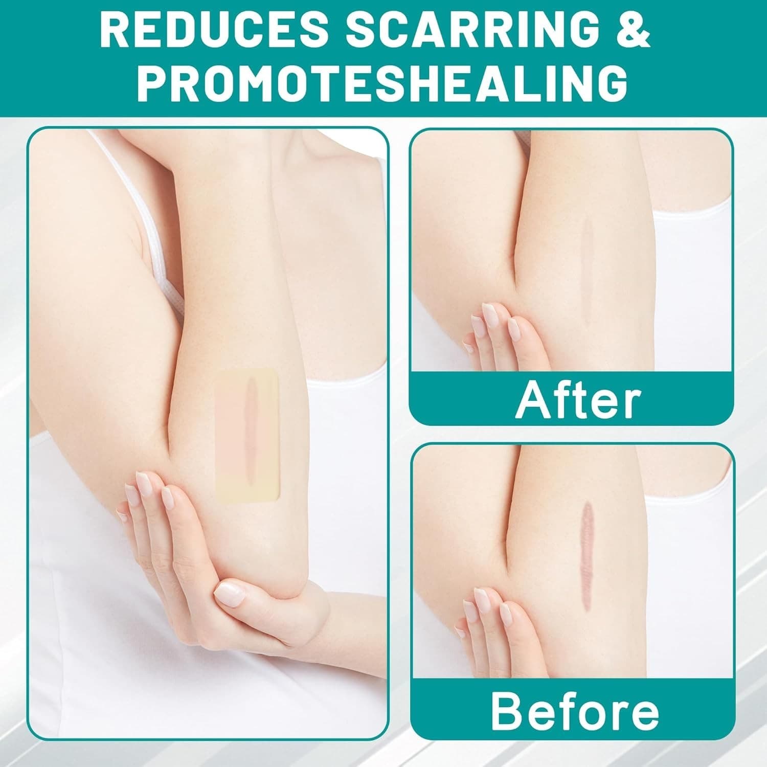 Hydrocolloid Bandages Roll for Wound Care, 2In*6Ft Hydrocolloid Patch, Hypoalle 2