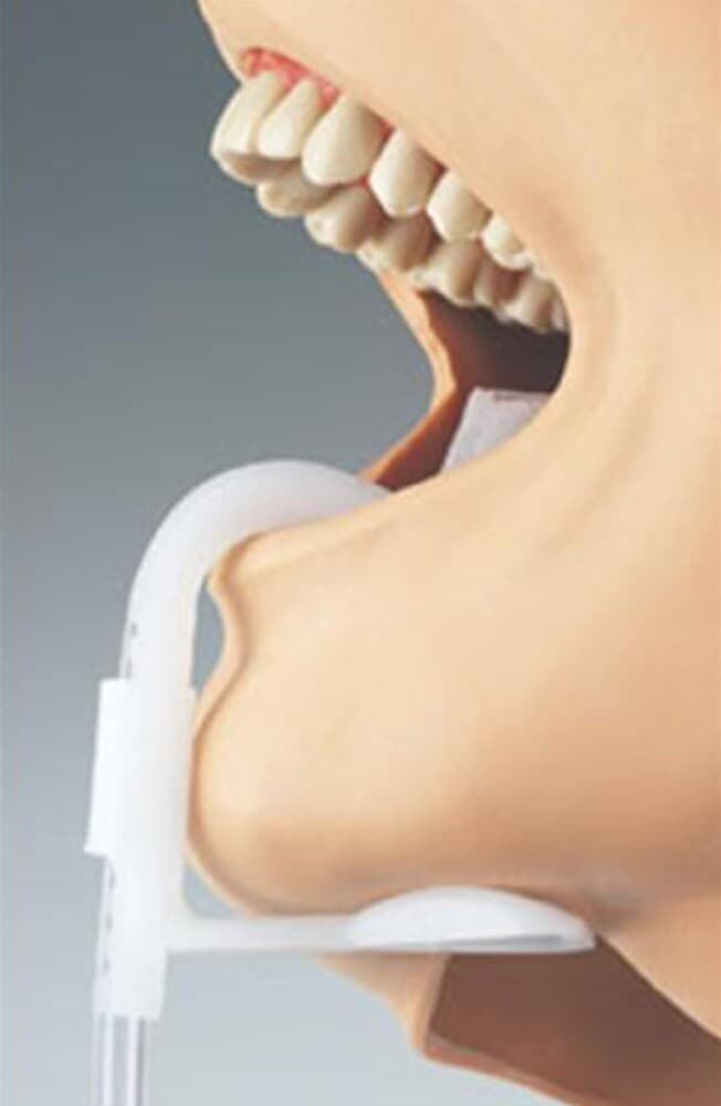 10 X Dental Disposable Lingua-Fix Saliva Dry Field Isolation Ejectors White 3