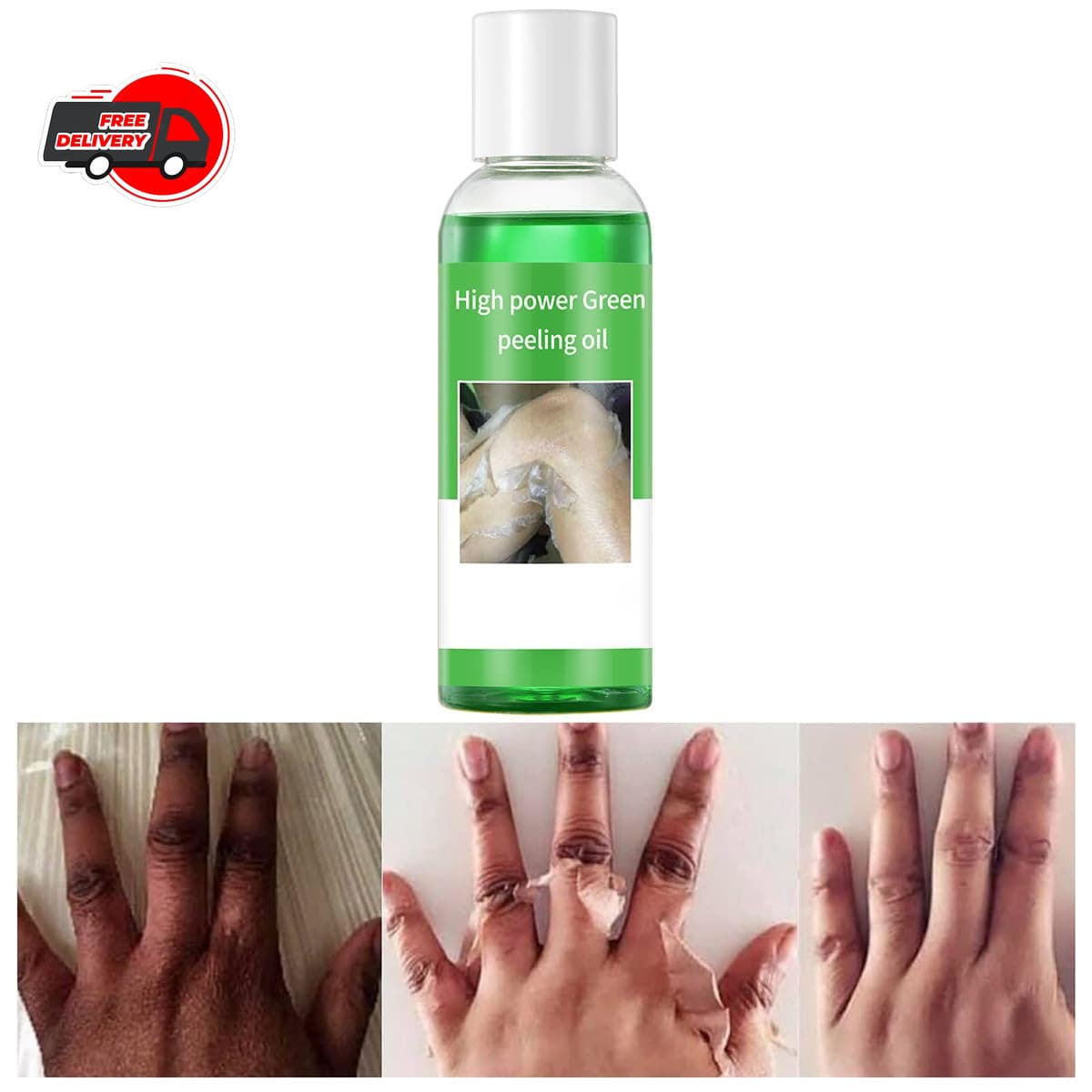 Peeling Oil for Dark Skin, Green Peeling Oil, Facial Peels with Hyaluronate,E...