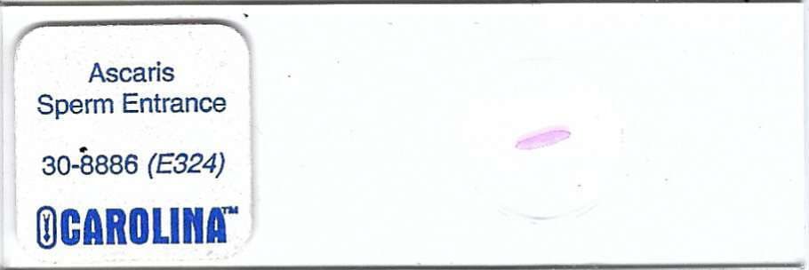 Ascaris sp. Sperm Entrance Microscope Slide